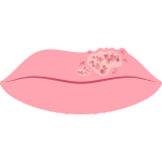 唇疱疹icon